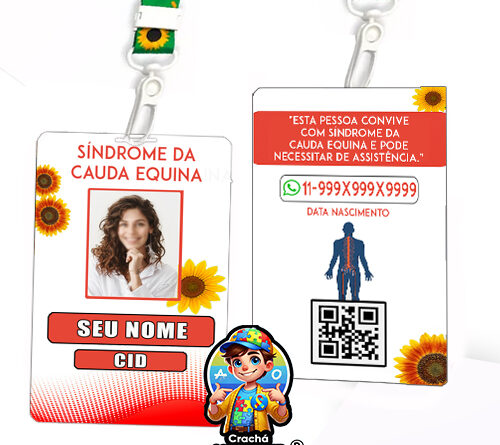 Crachá Síndrome da Cauda Equina com QR Code Inteligente e cordão girassol para identificação médica.