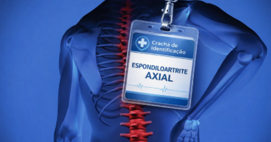 Crachá de identificação para espondiloartrite axial com cordão de girassol, utilizado para sinalizar deficiência oculta e facilitar atendimento em emergências