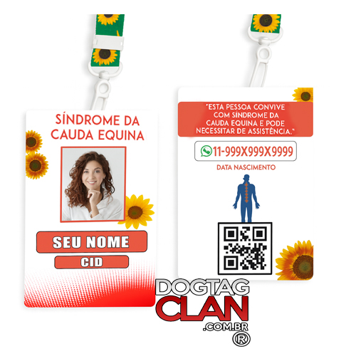 Crachá Síndrome da Cauda Equina Personalizado – Nome, CID e QR Code
